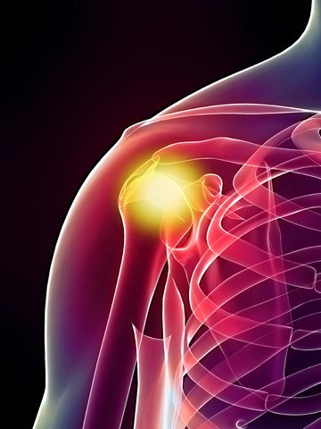 Adhesive Capsulitis | naturalcuredoctor